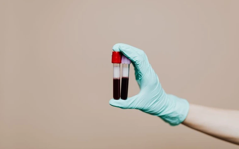 Gloved hand holding two vials of blood samples against a beige background