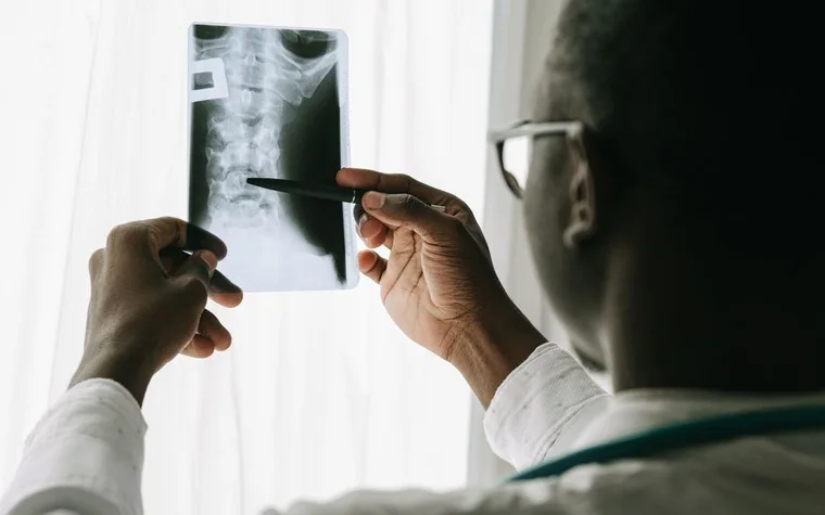 A clinician holds an X-ray film up to window light and points at it with a pen