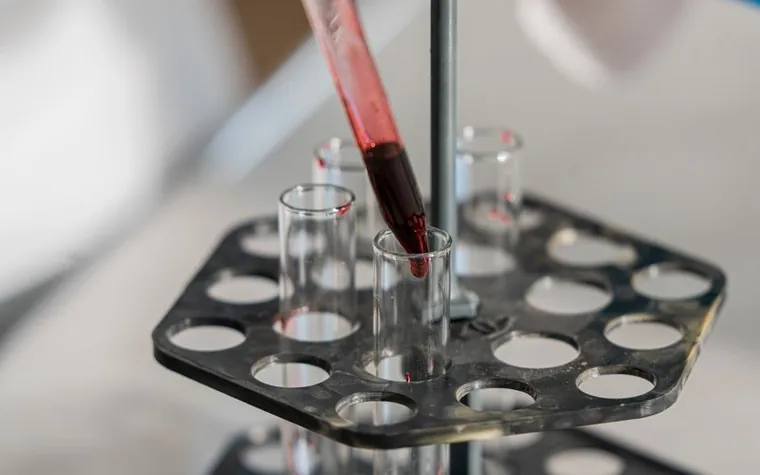 Blood sample being pipetted into a test tube rack in a laboratory