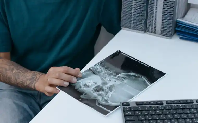 A person holding a printed animal X-ray film at a desk beside a keyboard