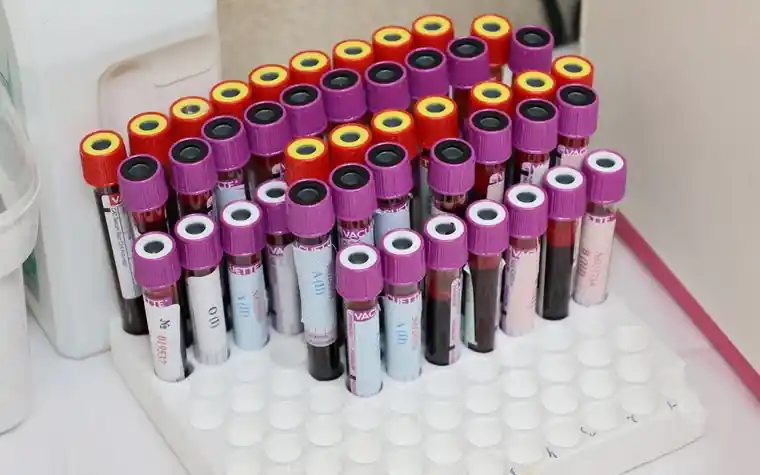 Rows of labelled blood sample tubes in a laboratory